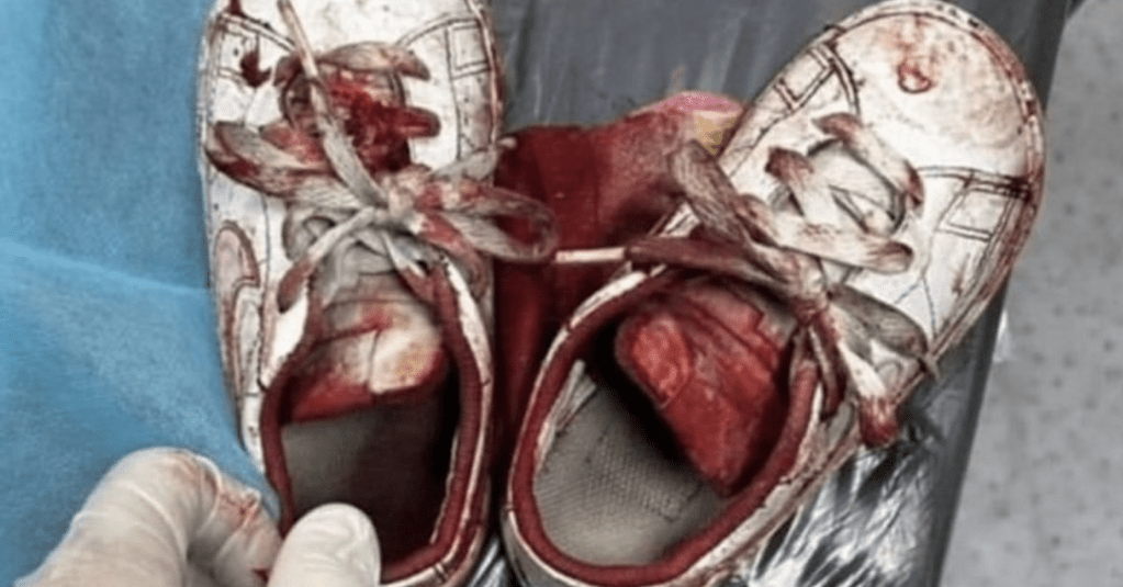 Letting The Cruelty Of The World Break Our Hearts&nbsp;Together