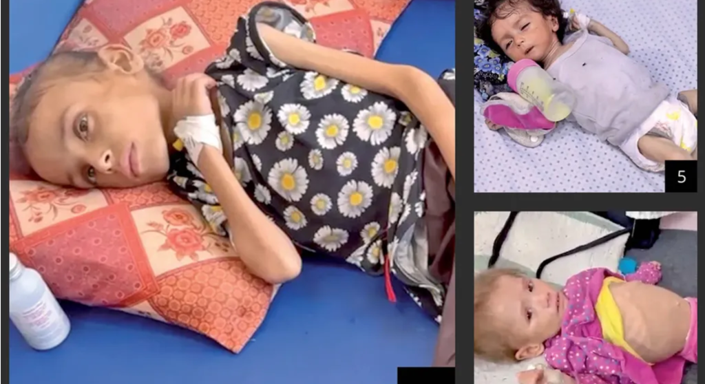 Only Liars And Manipulators Say Gaza Isn’t&nbsp;Starving